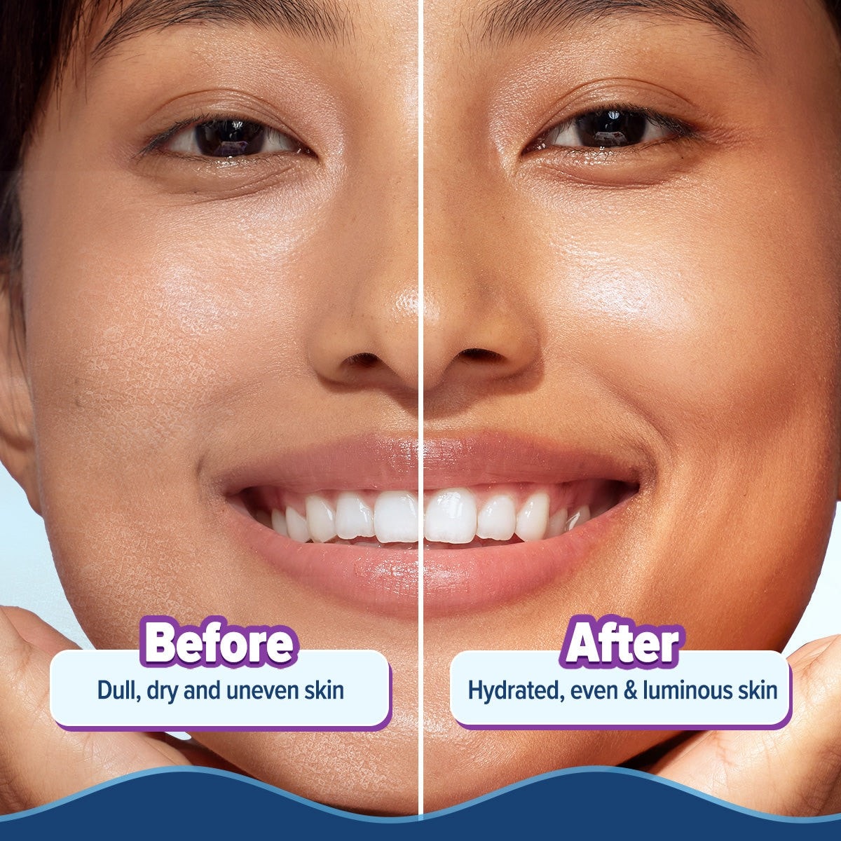 Before and after results for smoother hydrated skin