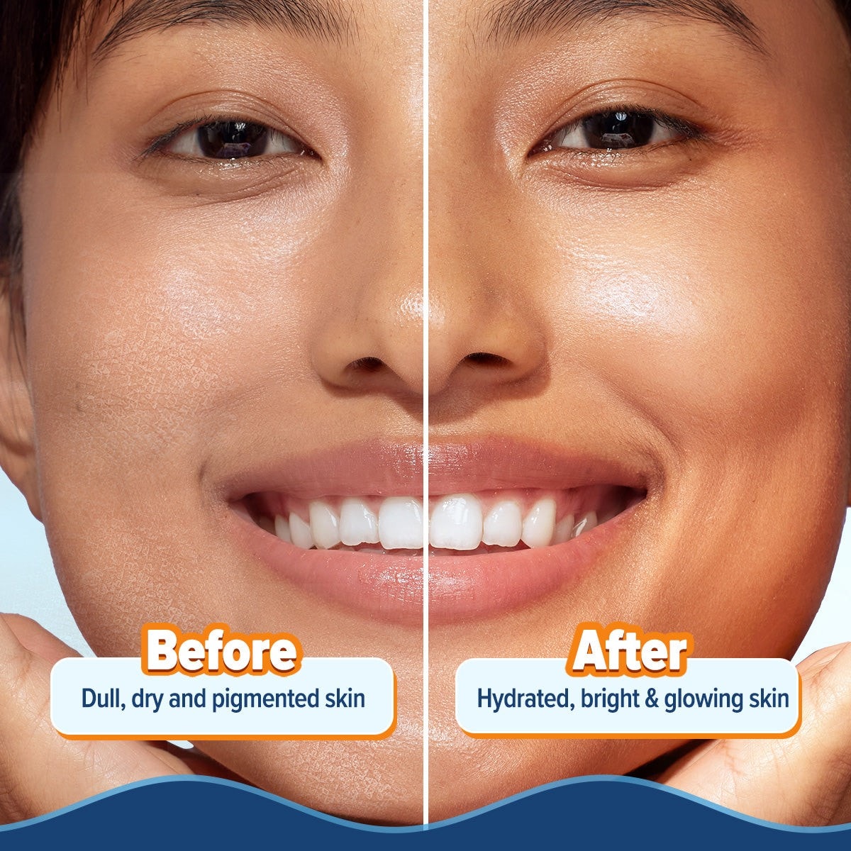 Before-and-after panel showing hydrated, smoother-looking skin