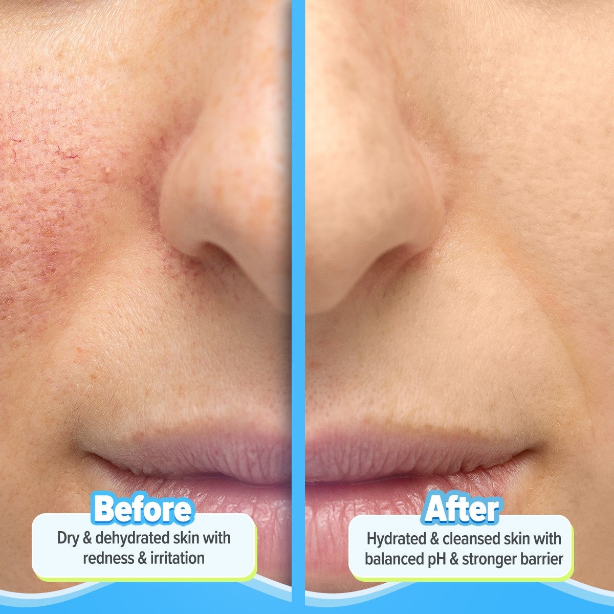 Barrier cleanser before after results
