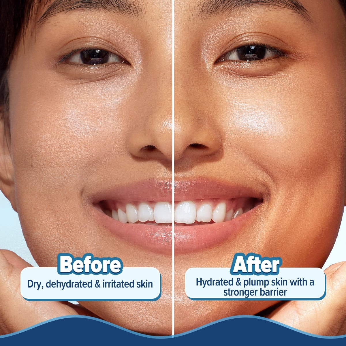 Before-and-after skin panel with smoother hydrated results